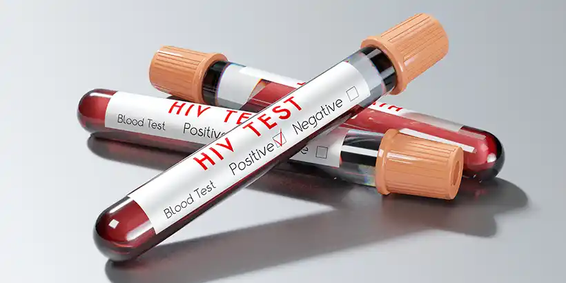 HIV Test